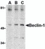 Western blot analysis of Beclin-1 in A431 cell lysate with Beclin-1 antibody at (A) 0.5, (B) 1 and (C) 2 &#956;g/mL.