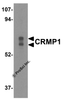 Western blot analysis of CRMP1 in Caco-2 cell lysate with CRMP1 antibody at 0.5 &#956;g/mL.