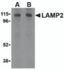 Western blot analysis of LAMP-2 in HepG2 cell lysate with LAMP-2 antibody at (A) 1 and (B) 2 &#956;g/mL.