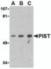 Western blot analysis of PIST in PC-3 cell lysate with PIST antibody at (A) 1, (B) 2 and (C) 4 &#956;g/mL.