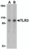 Western blot analysis of TLR3 in Daudi cell lysate with TLR3 antibody at (A) 1 and (B) 2 &#956;g/mL.