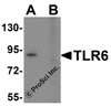 Western blot analysis of TLR6 in Daudi cell lysate with TLR6 antibody at 1 &#956;g/mL in (A) the absence and (B) the presence of blocking peptide.