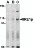 Western blot analysis of IRE1p in A-20 cell lysate with IRE1p antibody at (A) 0.5, (B) 1 and (C) 2 &#956;g/mL.