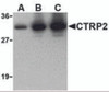 Western blot of recombinant CTRP2: (A) 5 ng, (B) 25 ng, and (C) 50 ng with CTRP2 at 1 &#956;g/mL.