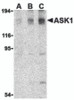 Western blot analysis of ASK1 in SW1353 cell lysate with ASK1 antibody at (A) 0.5, (B) 1, and (C) 2 &#956;g/mL.