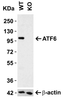 Figure 1 KO Validation of ATF6 
Loading: 15 &#956;g of human HeLa cell lysate 
Antibodies ATF6 3683, 0.5 &#956;g/mL, 1 h incubation at RT in 5% NFDM/TBST. 
Secondary: Goat Anti-Rabbit IgG HRP conjugate at 1:10000 dilution.