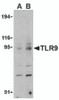 Western blot analysis of TLR9 in mouse spleen cell lysate with TLR9 antibody at (A) 0.5 and (B) 1 &#956;g/mL.