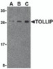 Western blot analysis of TOLLIP in rat brain cell lysate with TOLLIP antibody at (A) 0.5, (B) 1 and (C) 2&#956;g/mL.