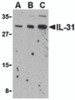 Western blot analysis of IL-31 in RAW264.7 cell lysate with IL-31 antibody at (A) 2.5, (B) 5 and (C) 10 &#956;g/mL.