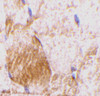 Immunohistochemistry of IL-31 in rat skeletal muscle tissue with IL-31 antibody at 10 ug/mL.