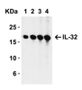 Figure 1 Western Blot Validation with Recombinant Protein
Loading: 30 ng of human IL-32 recombinant protein per lane.
Antibodies: IL-32, 3751 (Lane 1: 0.5 &#956;g/mL, Lane 2: 1 &#956;g/mL, Lane 3: 2 &#956;g/mL and Lane 4: 4 &#956;g/mL) , 1h incubation at RT in 5% NFDM/TBST.
Secondary: Goat anti-rabbit IgG HRP conjugate at 1:10000 dilution.
Observed at around 17kD.