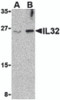 Figure 2 Western Blot Validation in Jurkat Cell Lysate
Loading: 15 ug of lysates per lane.
Antibodies: IL-32, 3751 (A: 2.5 ug/mL and B: 5 ug/mL) , 1h incubation at RT in 5% NFDM/TBST.
Secondary: Goat anti-rabbit IgG HRP conjugate at 1:10000 dilution.