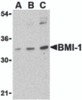 Western blot analysis of BMI-1 in K562 cell lysate with BMI-1 antibody at (A) 0.5, (B) 1 and (C) 2 &#956;g/mL.