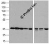 Western blot analysis of GAPDH in A431, Daudi, HepG2, HL60, Jurkat, Human kidney, Mouse lung, and Chicken liver lysate with GAPDH antibody 0.5 &#956;g/mL.