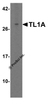 Western blot analysis of TL1A in human placenta tissue lysate with TL1A antibody at 2 &#956;g/mL.