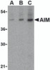 Western blot analysis of AIM in human lymph node tissue lysate with AIM antibody at (A) 1, (B) 2 and (C) 4 &#956;g/mL.