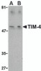 Western blot analysis of TIM-4 in Jurkat lysate with TIM-4 antibody at (A) 1 and (B) 2 &#956;g/mL.