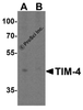 Western blot analysis of TIM-4 in RAW264.7 cell lysate with TIM-4 antibody at 2 &#956;g/mL in (A) the absence and (B) the presence of blocking peptide.