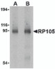 Western blot analysis of RP105 in human spleen tissue lysate with RP105 antibody at (A) 0.5 and (B) 1 &#956;g/mL.