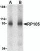 Western blot analysis of RP105 in human spleen tissue lysate with RP105 antibody at (A) 0.5 and (B) 1 &#956;g/mL.