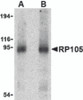 Western blot analysis of RP105 in human spleen tissue lysate with RP105 antibody at (A) 0.5 and (B) 1 &#956;g/mL.