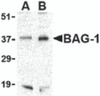 Western blot analysis of BAG-1 in PC-3 cell lysate with BAG-1 antibody at (A) 1 and (B) 2 &#956;g/mL.