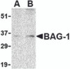 Western blot analysis of BAG-1 in PC-3 cell lysate with BAG-1 antibody at (A) 1 and (B) 2 &#956;g/mL.