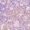 Immunohistochemistry of BAG-1 in human lymph node tissue with BAG-1 antibody at 2 ug/mL