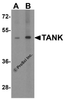 Western blot analysis of TANK in human kidney tissue lysate with TANK antibody at (A) 1 and (B) 2 &#956;g/mL.