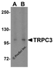 Western blot analysis of TRPC3 in human heart tissue lysate with TRPC3 antibody at (A) 1 and (B) 2 &#956;g/mL.