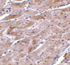 Immunohistochemistry of TRPC3 in mouse heart tissue with TRPC3 antibody at 10 ug/mL.