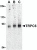 Western blot analysis of TRPC6 in mouse lung tissue lysate with TRPC6 antibody at (A) 0.5, (B) 1 and (C) 2 &#956;g/mL.