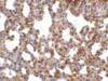 Immunohistochemistry of TRPC6 in mouse lung tissue with TRPC6 antibody at 10 ug/mL.