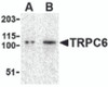 Western blot analysis of TRPC6 in K562 cell lysate with TRPC6 antibody at (A) 0.5 and (B) 1 &#956;g/mL.