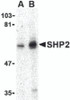Western blot analysis of SHP2 in mouse skeletal muscle tissue lysate with SHP2 antibody at (A) 0.5 and (B) 1 &#956;g/mL.