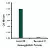 Hemagglutinin antibody at 1 ug/mL specifically recognizes Avian H5N1 influenza virus but not seasonal influenza virus A H1N1 Hemagglutinin protein.