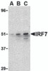 Western blot analysis of IRF7 in 293 whole cell lysate with IRF7 antibody at (A) 0.5, (B) 1, and (C) 2 &#956;g/mL.