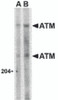 Western blot analysis of ATM in Daudi whole cell lysate with ATM antibody at (A) 1 and (B) 2 &#956;g/mL.