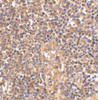 Immunohistochemistry of ATM in human lymph node tissue with ATM antibody at 2.5 ug/mL.