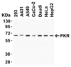 Figure 1 Western Blot Validation of PKR in Human Cell Lines 
Loading: 15 &#956;g of lysates per lane.
Antibodies: PKR 3947 (1 &#956;g/mL) , 1h incubation at RT in 5% NFDM/TBST.
Secondary: Goat anti-rabbit IgG HRP conjugate at 1:10000 dilution.