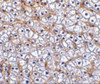Immunohistochemistry of Fn14 in human liver tissue with Fn14 antibody at 2.5 ug/mL.