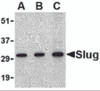 Western blot analysis of Slug in 293 cell lysate with Slug antibody at in (A) 0.5, (B) 1 and (C) 2 &#956;g/mL.