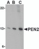 Western blot analysis of PEN2 in K562 cell lysate with PEN2 antibody at (A) 0.5, (B) 1, and (C) 2 &#956;g/mL.