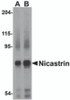 Western blot analysis of Nicastrin in human brain tissue lysate with Nicastrin antibody at (A) 0.5 and (B) 1&#956;g/mL.