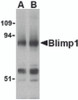 Western blot analysis of Blimp-1 in mouse lung tissue lysate with Blimp-1 antibody at (A) 0.5 and (B) 1&#956;g/mL.