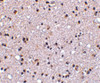 Immunohistochemistry of TMP21 in human brain tissue with TMP21 antibody at 5 ug/mL.