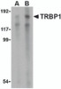 Western blot analysis of TRBP1 in 3T3 cell lysate with TRBP1 antibody at (A) 1 and (B) 2 &#956;g/mL.