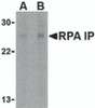 Western blot analysis of RPA Interacting Protein in Jurkat cell lysate with RPA Interacting Protein antibody at (A) 1 and (B) 2 &#956;g/mL.