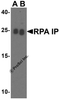 Western blot analysis of RPA Interacting Protein in Jurkat cell lysate with RPA Interacting Protein antibody at (A) 0.5 and (B) 1 &#956;g/mL.