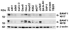 Figure 1 Independent Antibody Validation (IAV) via Protein Expression Profile in Human Lines
Loading: 15 &#956;g of lysates per lane.
Antibodies: BANF1, 4017 (2 &#956;g/mL) , BANF1, 4019 (2 &#956;g/mL) and beta-actin (1.5 &#956;g/mL) , 1h incubation at RT in 5% NFDM/TBST.
Secondary: Goat anti-rabbit IgG HRP conjugate at 1:10000 dilution.